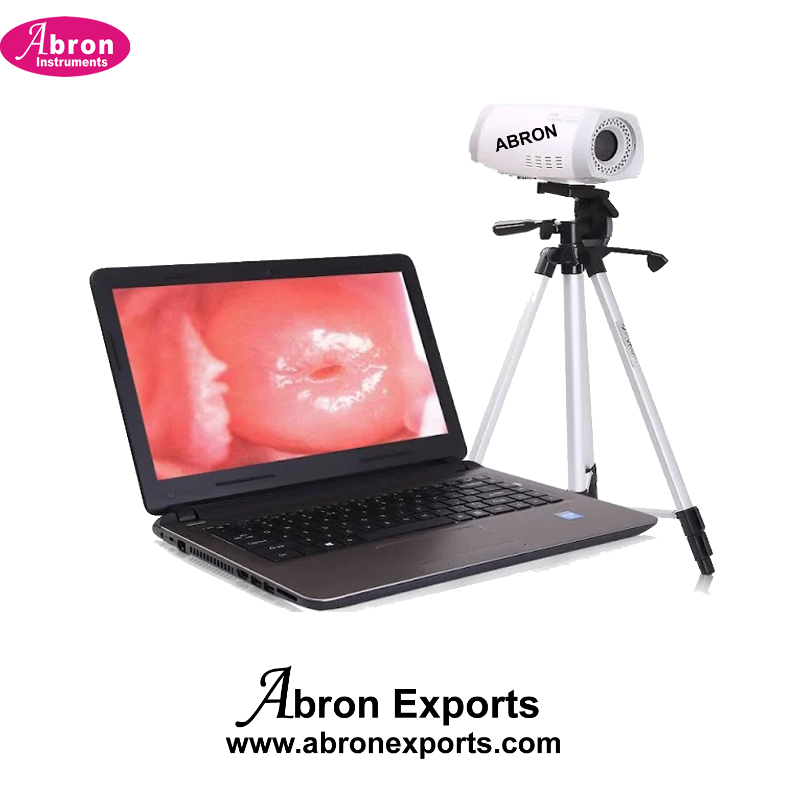 Gynecology Digital Video Colposcope with Reporting with continuous zoom to 40x with outputs Abron ABM-2904A40X